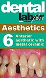 Anterior aesthetic with metal ceramic (dental lab technology articles)