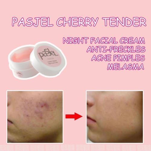 Beauty Set : Pasjel Cherry Tender Night Facial Cream Anti-freckles Acne Pimples Melasma 10ml (pack of 2) [Free Facial Hair Epicare Spring A1Remover]