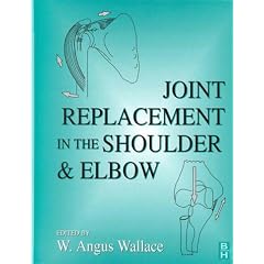 Joint Replacement in the Shoulder and Elbow