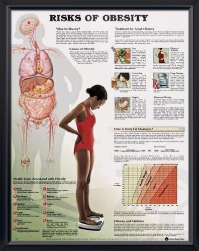 Risks of Obesity, DeuPair 20x26" Pocket Frame Human Anatomy Poster