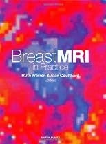 Breast MRI in Practice