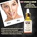New 3 in 1 Best Organic Vitamin C 35% Serum + Hyaluronic Acid + Hydrolyze Collagen + Retinoic Acid. Collagen Booster Helps Repair Sun Damage, Fade Age Spots, Dark Circles, Wrinkles & Fine Lines
