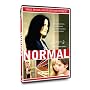 Normal