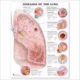 Diseases of the Lung Anatomical Chart
