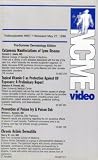 Cutaneous Manifestations of Lyme Disease/Topical Vitamin C as Protection Against UV Exposure/Prevision of Poison Ivy & Poison Oak/Chronic Actinic Dematitis (NCME Video 697)