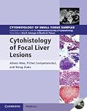 Cytohistology of focal liver lesions