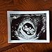 Prank 2D Customized Ultrasound SINGLE PHOTO ONLY