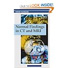 Normal Findings in CT and MRI (Thieme Flexibook) by Torsten Moeller and Emil Reif