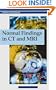 Normal Findings in CT and MRI (Thieme Flexibook)