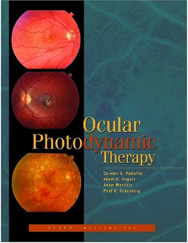 Cover image : Ocular Photodynamic Therapy