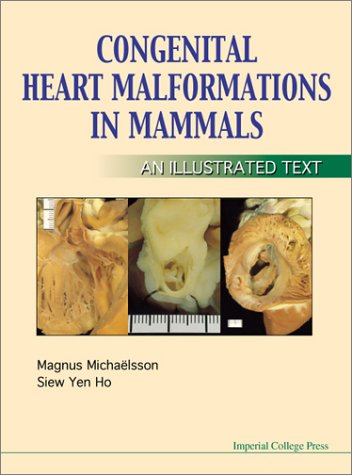 Congenital-Heart-Disease