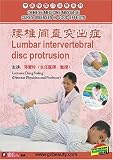 CHINESE MEDICINE MASSAGE CURES DISEASES IN GOOD EFFECTS--Lumbar intervertebral disc protrusion