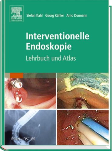 Interventionelle Endoskopie 3437236202 pdf