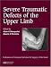 Books : Severe Tramatic Defects of the Upper Limb: Published in association with the Federation of European Societies for Surgery of the Hand