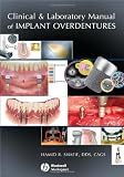 Clinical and Laboratory Manual of Implant Overdentures
