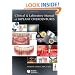 Clinical and Laboratory Manual of Implant Overdentures
