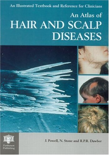 An Atlas of Hair and Scalp Diseases (Encyclopedia of Visual Medicine Series)