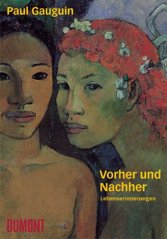 Vorher und Nachher: Lebenserinnerungen Vorher und Nachher: Lebenserinnerungen