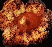Genes and Disease - Diseases of the Eye