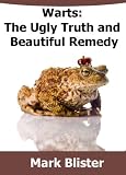 Warts: The Ugly Truth and Beautiful Remedy