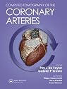 Computed Tomography of the Coronary Arteries