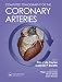 Computed Tomography of the Coronary Arteries