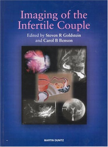 Infertility