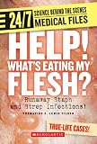 Help! What's Eating My Flesh?: Runaway Staph and Strep Infections! (24/7: Science Behind the Scenes)