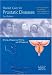 Books : Shared Care For Prostatic Diseases (Shared Care)