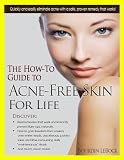The How-To Guide to Acne-Free Skin For Life The How-To Guide to Acne-Free Skin For Life