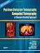 Search : Positron Emission Tomography-Computed Tomography: A Disease-Oriented Approach