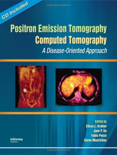 Computed-Tomography