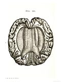 Corpus Callosum of Brain Giclee Poster Print, 24x32