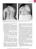 Physiotherapie in der Orthop�die - 