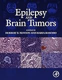 Epilepsy and brain tumors