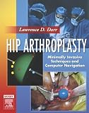 Hip Arthroplasty: Minimally Invasive Techniques and Computer Navigation, Text with DVD-ROMS