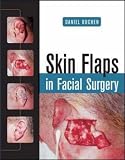 Skin Flaps in Facial Surgery