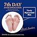 Wonder Foot Exfoliating Foot Mask - with Lactic Acid & Milk (PH3.6) – Guaranteed to Rejuvenate Your foot In 7 Days - Sold Exclusively on Amazon