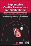 Implantable Cardiac Pacemakers and Defibrillators: All You Wanted to Know