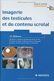 Imagerie des testicules et du contenu scrotal Imagerie des testicules et du contenu scrotal