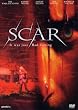 Scar