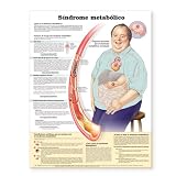 Metabolic Syndrome Anatomical Chart in Spanish