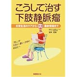 こうして治す 下肢静脈瘤