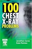 100 Chest X-Ray Problems