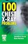 100 Chest X-Ray Problems, 1e