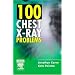 100 Chest X-Ray Problems, 1e