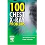 100 Chest X-Ray Problems