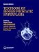 Books : Textbook of Benign Prostatic Hyperplasia