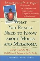 What You Really Need to Know about Moles and Melanoma