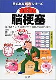 徹底図解 脳梗塞―前ぶれをキャッチ・血液をサラサラにして後遺症に克つ (目でみる医書シリーズ)